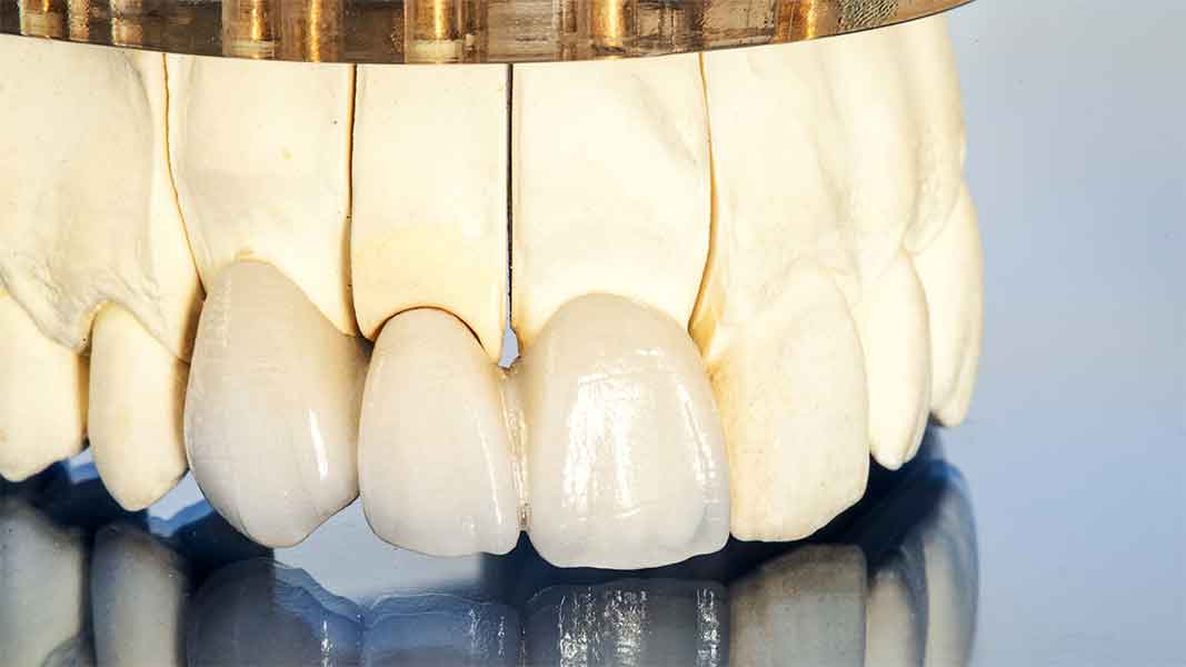 Próteses Dentárias